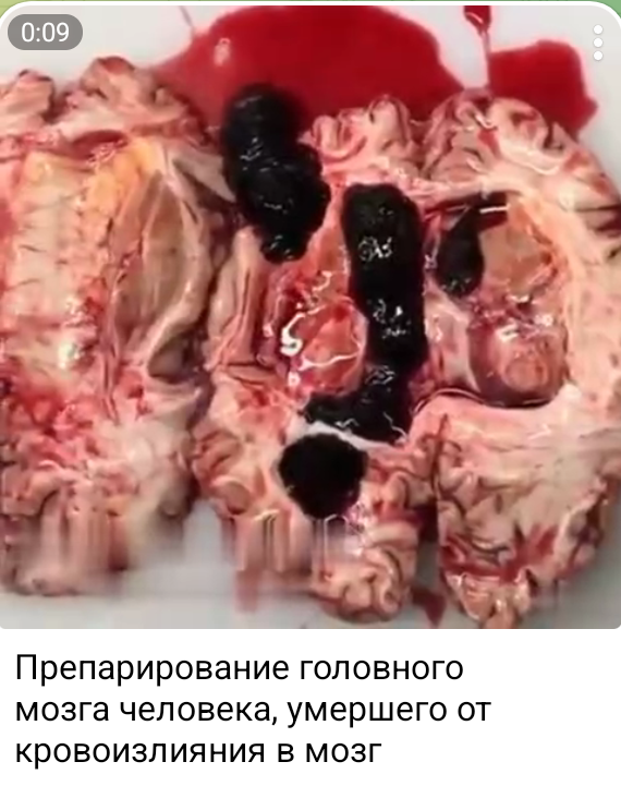 Screenshot_20260906-211941_1.png