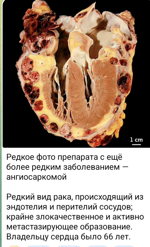 Screenshot_20260906-213847_1.png